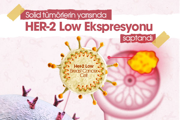 Solid tümörlerin yarısında HER-2 Low (düşüz pozitiflik) ekspresyonu saptandı
